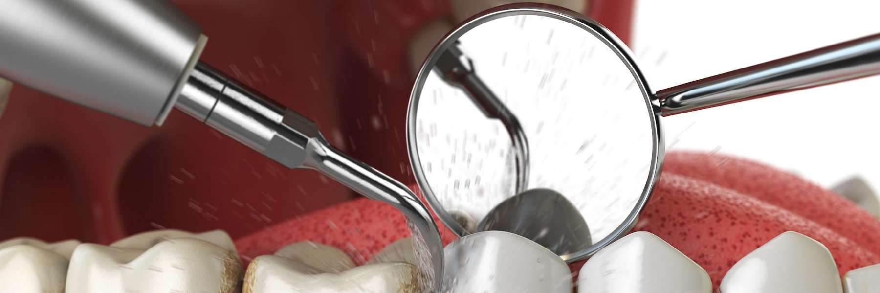 dental tools used for cleaning