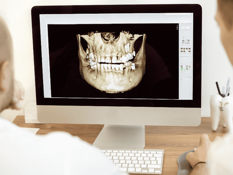 CBCT Cone Beam Technology